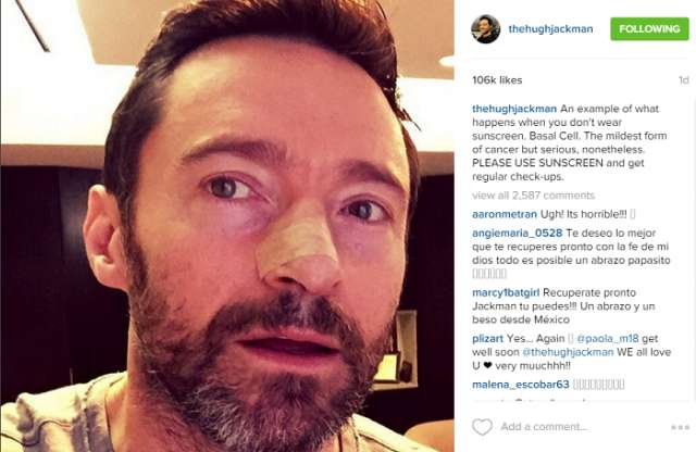 Actor Hugh Jackman has another skin cancer scare